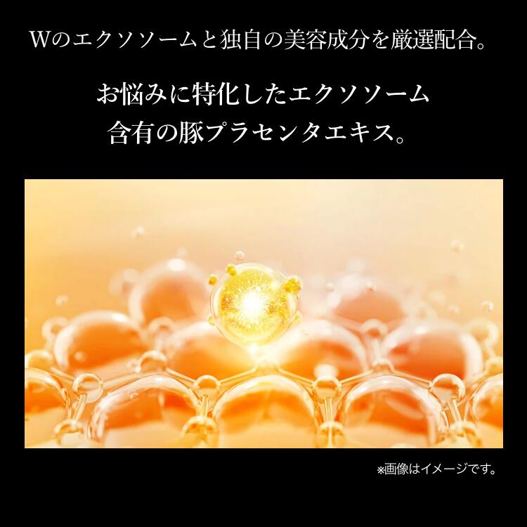 エクストラソーム プレミアム